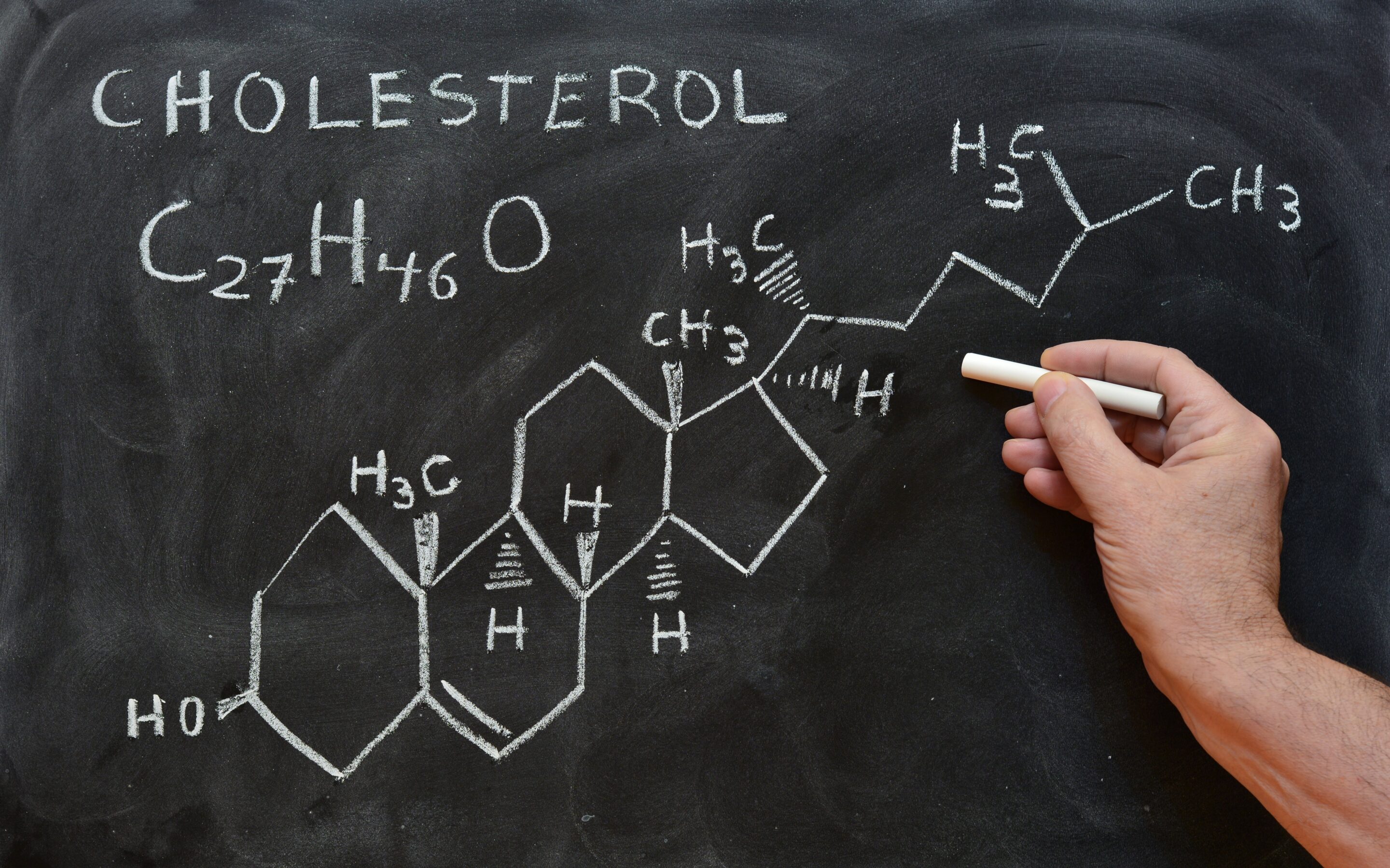 Wysoki cholesterol i co dalej, czyli kilka słów o statynach