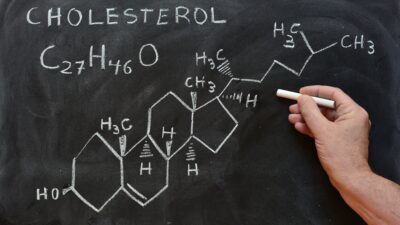 Wysoki cholesterol i co dalej, czyli kilka słów o statynach