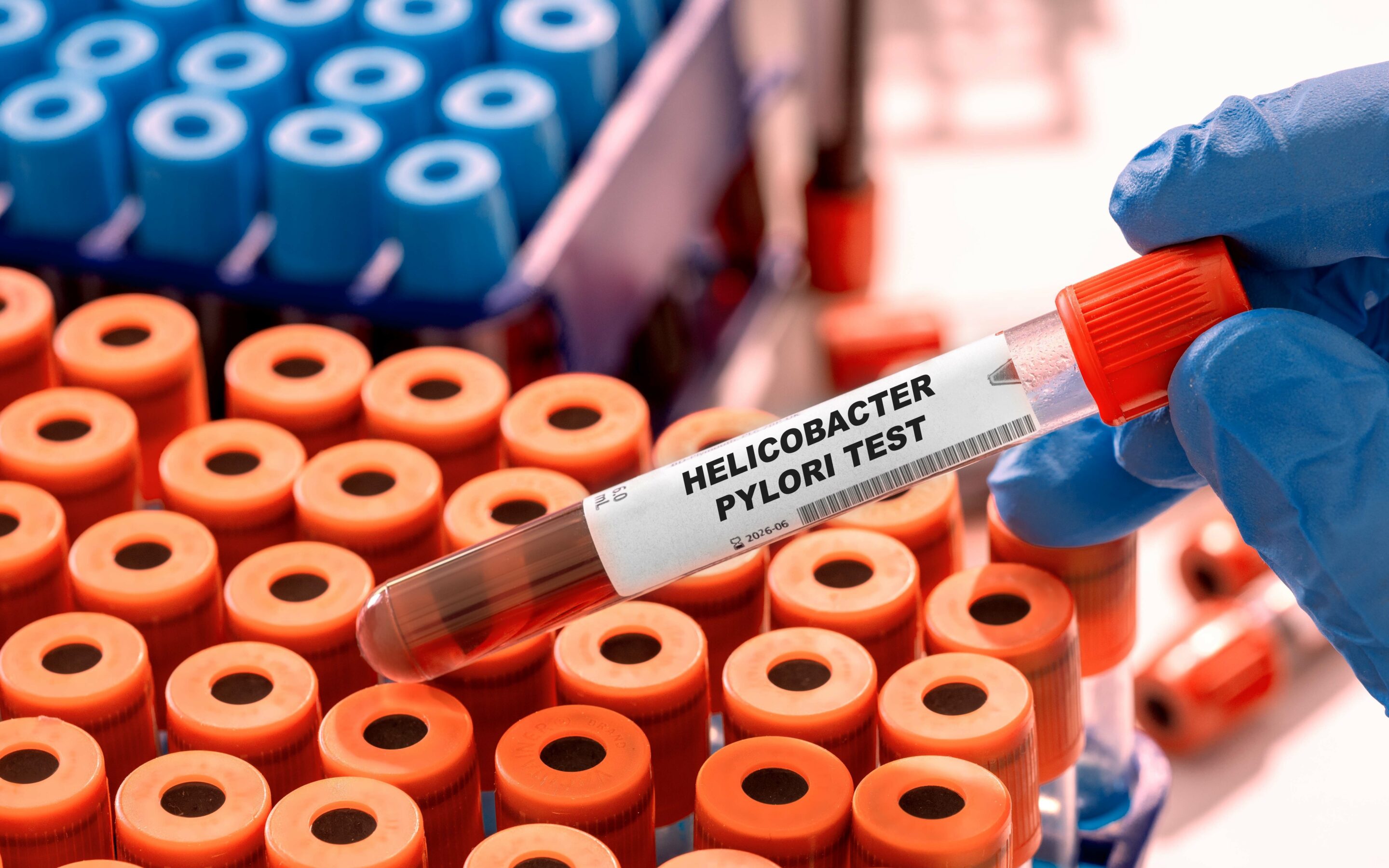 Helicobacter pylori: zakażenie, konsekwencje i leczenie
