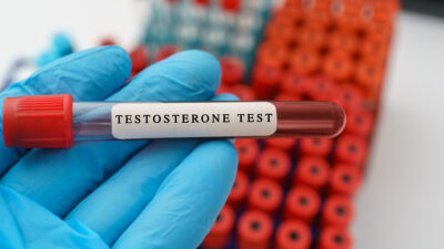 Dieta a testosteron: męska recepta na zdrowie