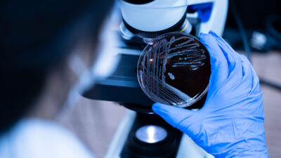 Epidemia zakażeń bakteriami E.coli w Anglii: zmarły dwie osoby, w tym 11-letnie dziecko