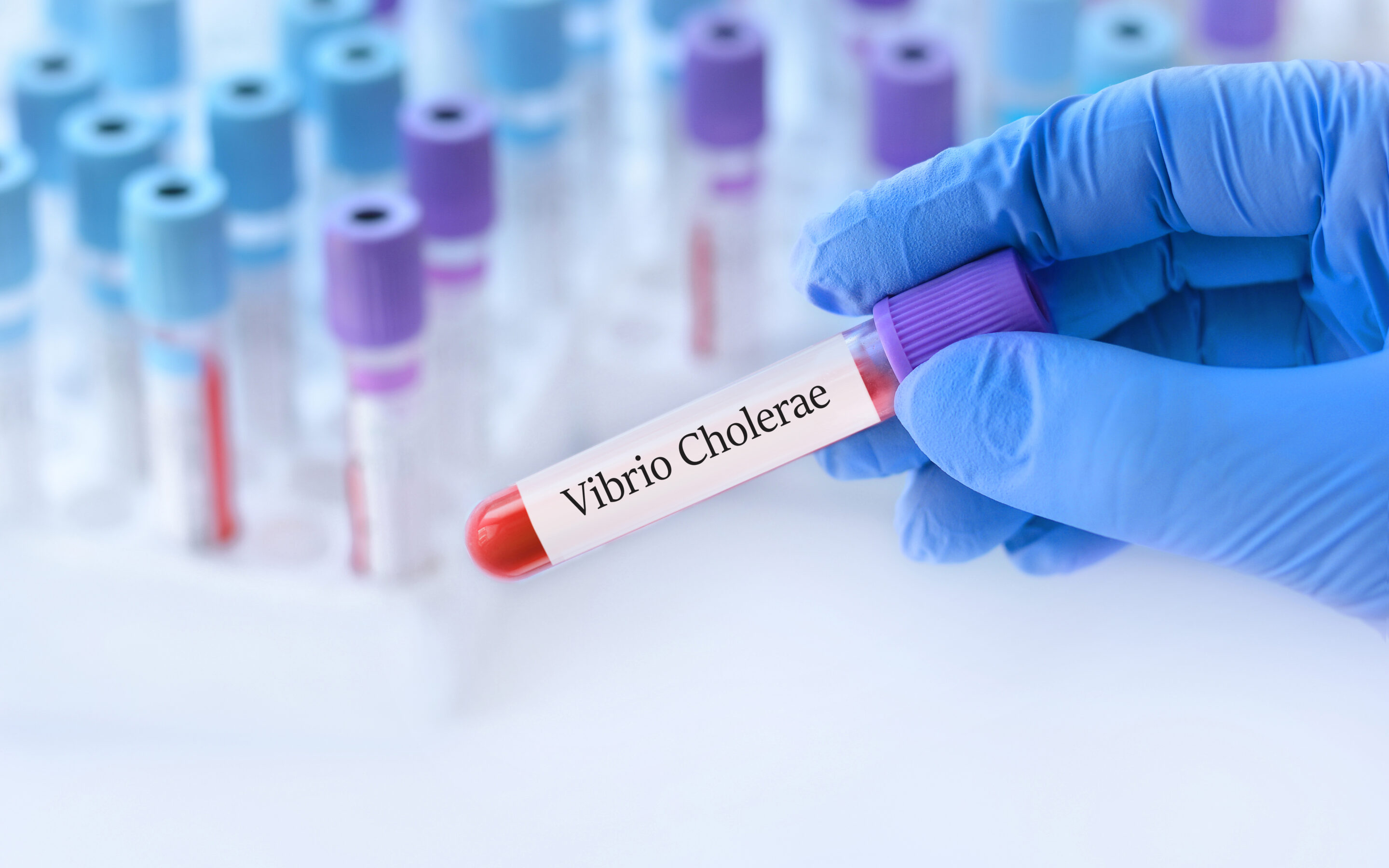 Cholera w Polsce: zachorowała starsza kobieta. Przebywa w szpitalu, nie wiadomo, jak się zaraziła.