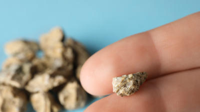 Pierwotna hiperoksaluria: choroba nerek, której źródło tkwi w wątrobie. „To ogromny problem systemowy”