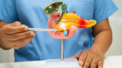 Rak trzustki: cichy agresor i nowe światełka nadziei. Czy inhibitory RAS to nadzieja na przełom?