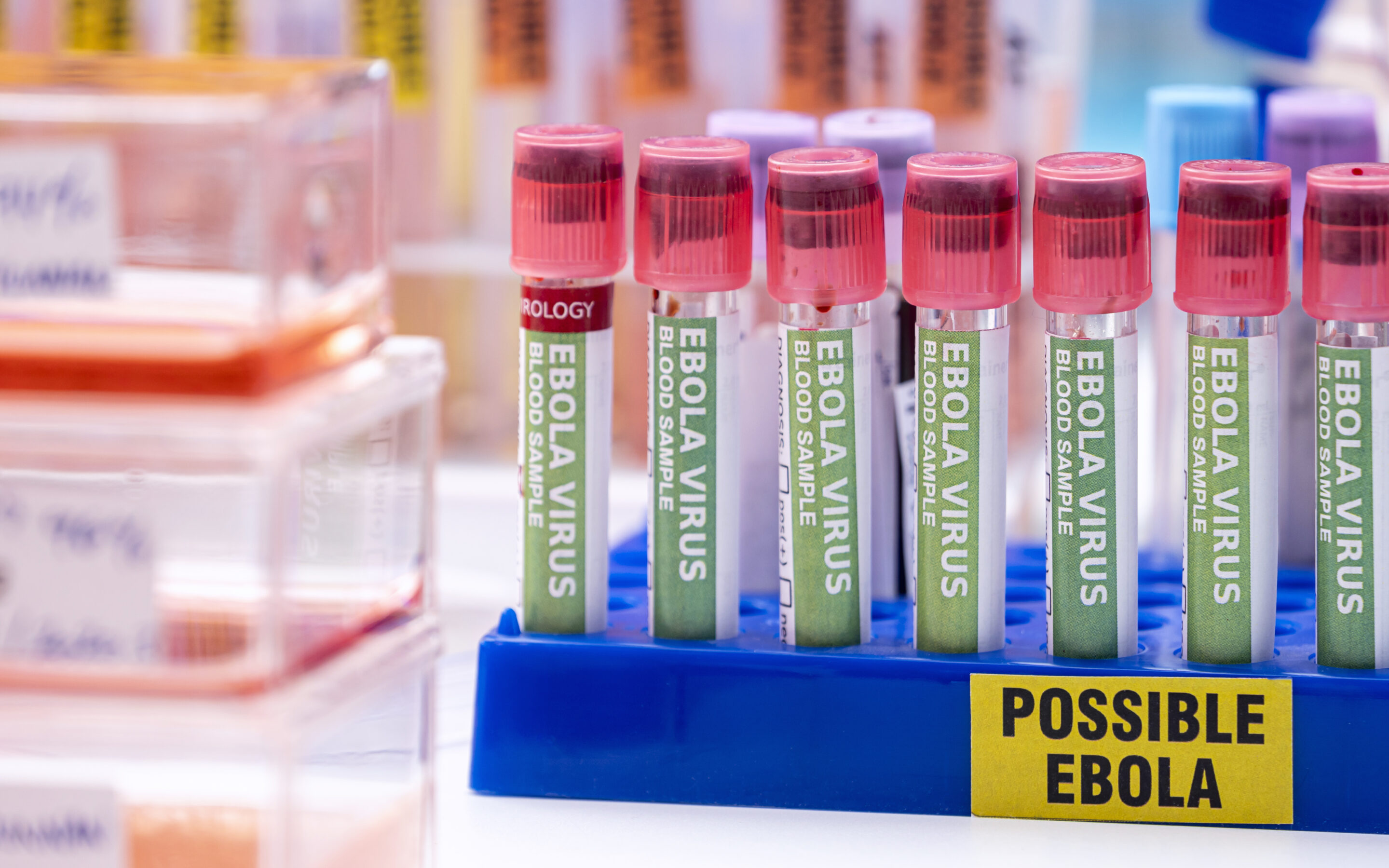 Alert WHO: Ebola znów atakuje. Czy mamy powody do obaw? [WYJAŚNIAMY]